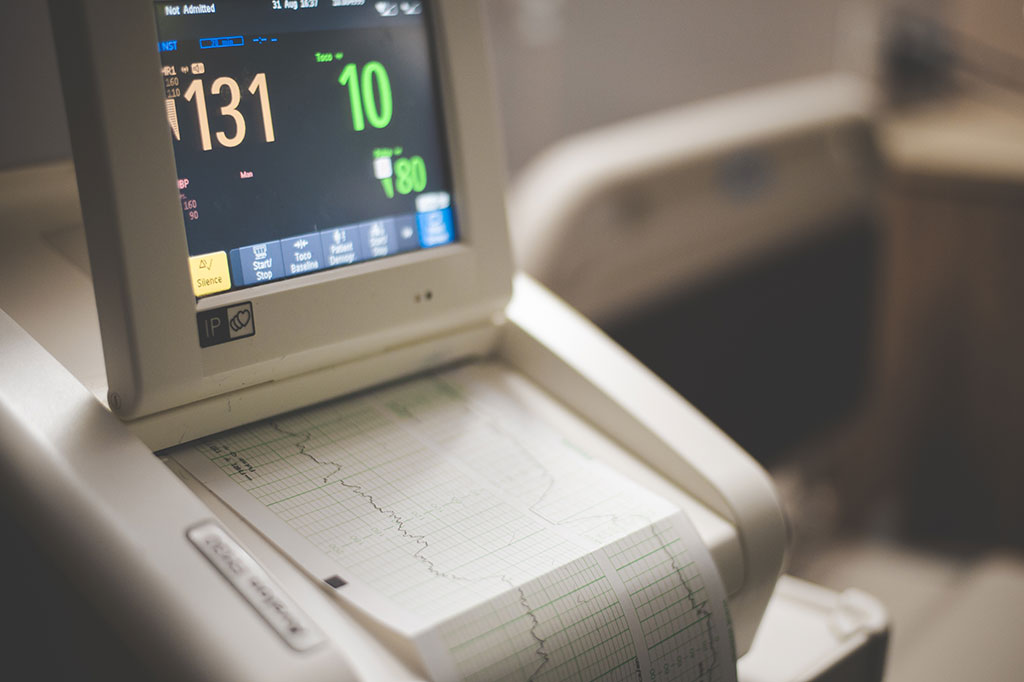 Image: Echocardiography can identify novel measures linked to higher dementia risk (Photo courtesy of Unsplash)
