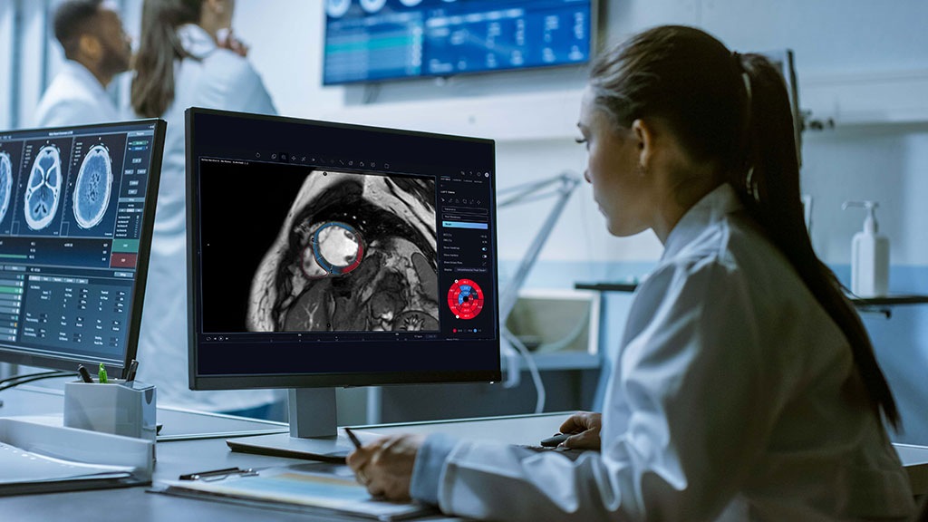 Image: New modules have been added to Cardio AI clinical application (Photo courtesy of Arterys)