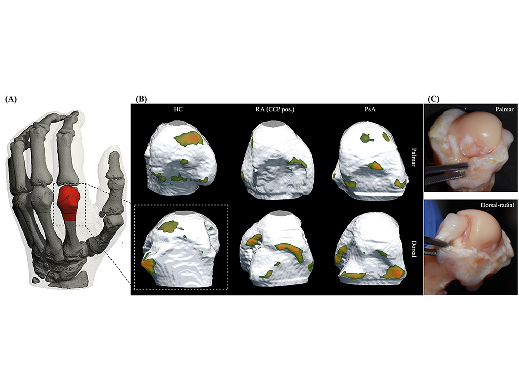 Image: CT from finger joint (Photo courtesy of FAU)