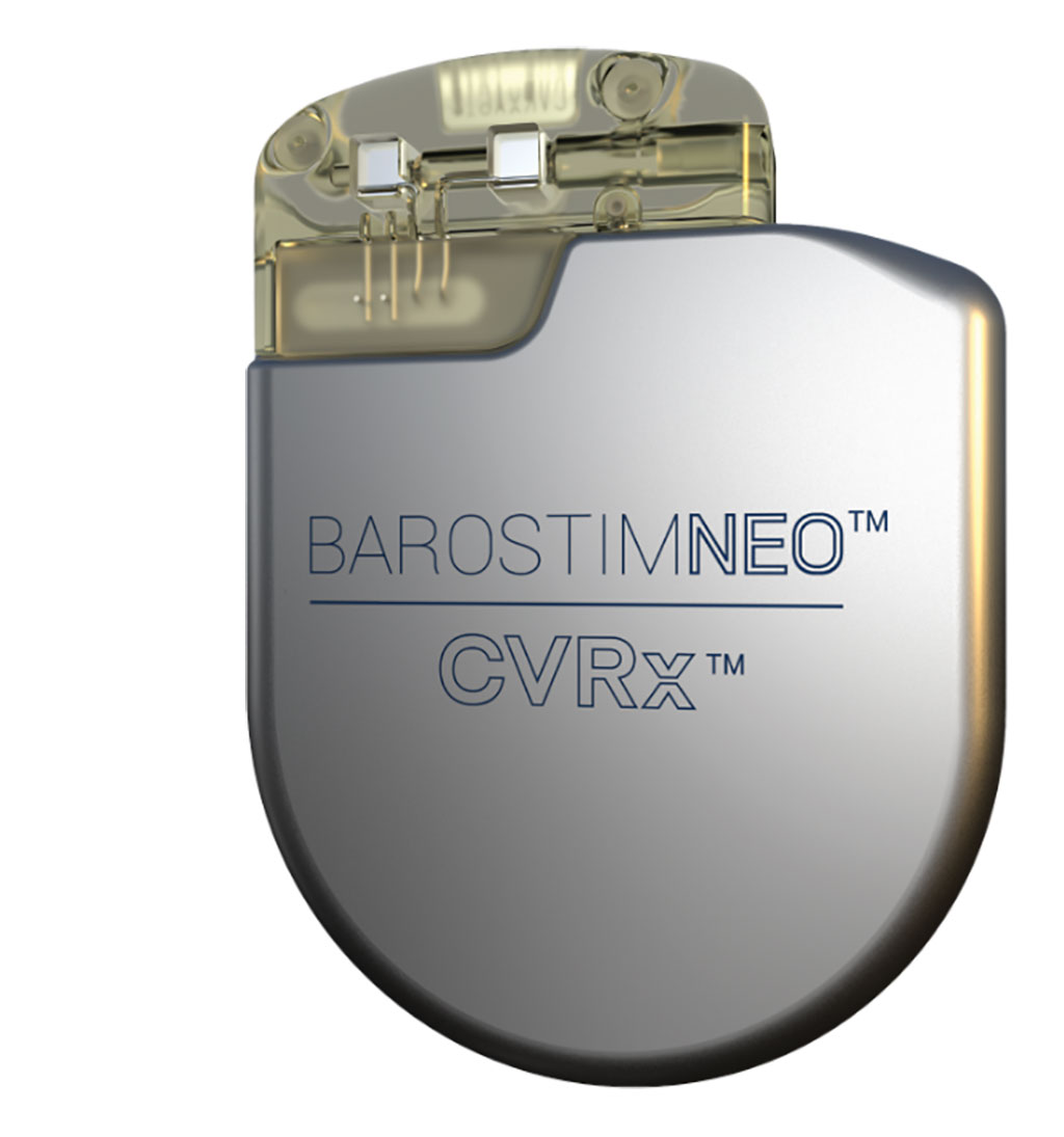 Image: BarostimNEO implantable pulse generator (Photo courtesy of CVRx)