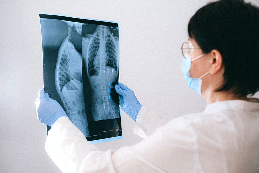 Image: Quantitative CT lung imaging and ML improves prediction of ED visits and hospitalizations in COPD (Photo courtesy of Pexels)