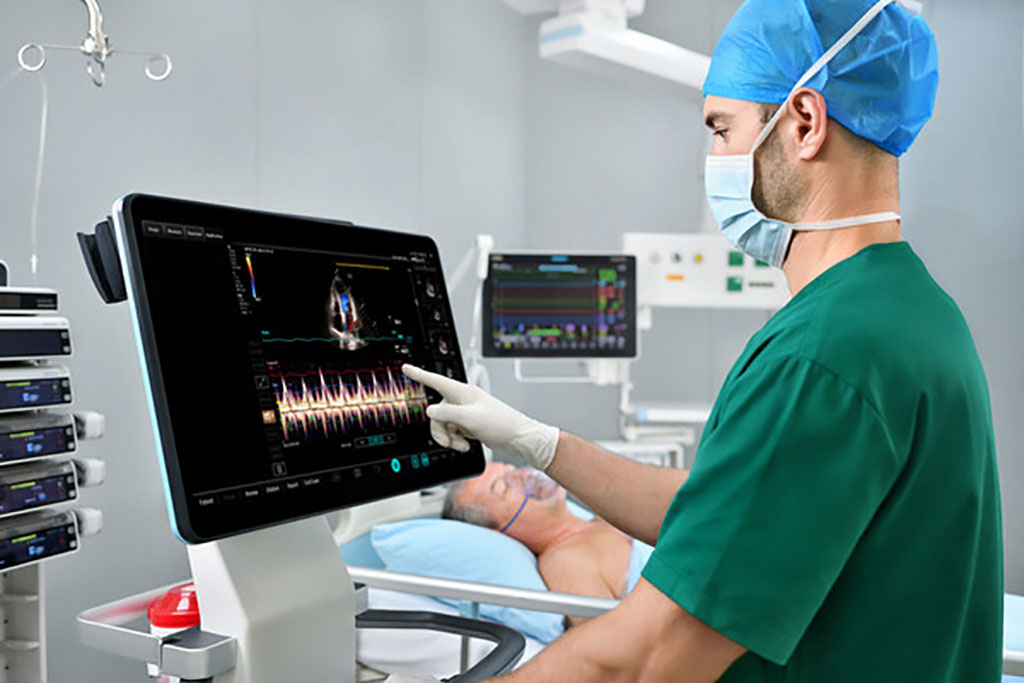 Image: The new TEX20 diagnostic ultrasound series reimagines POC systems (Photo courtesy of Mindray)