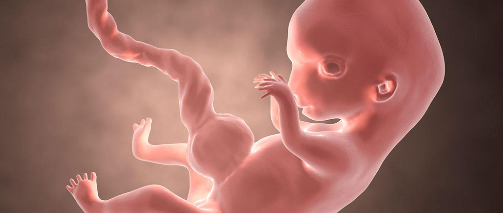 Image: Researchers used AI to diagnose birth defect in fetal ultrasound images (Photo courtesy of University of Ottawa)
