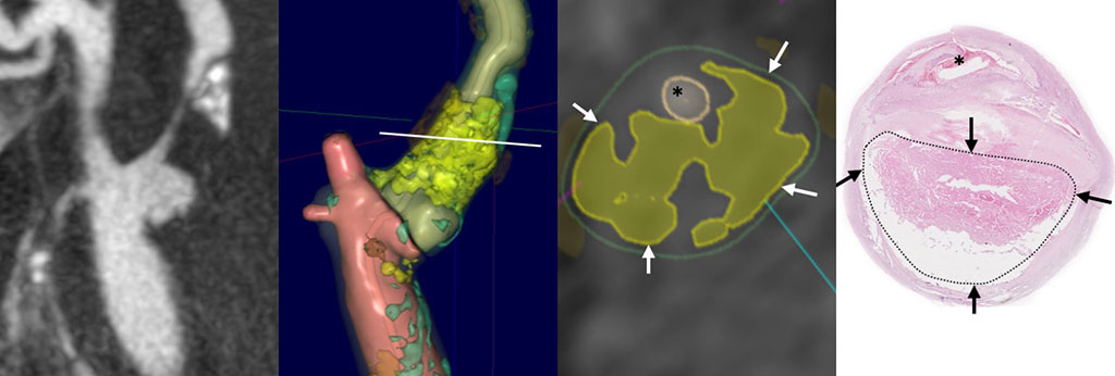 Image: ElucidVivo diagnostic imaging software is propelling the fight against CVD (Photo courtesy of Elucid)