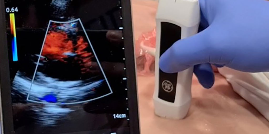 Image: Paramedics can literally see the functioning of a patient`s heart using ultrasound technology (Photo courtesy of MDA)