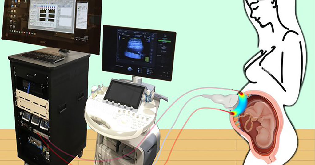 Image: The new device can better measure blood flow and oxygenation in the placenta (Photo courtesy of University of Pennsylvania)