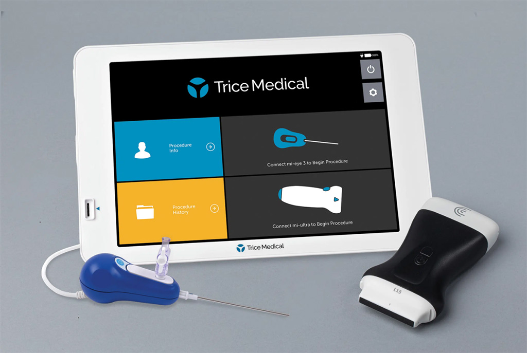 Image: The new mi-ultra with mi-tablet 3 (Photo courtesy of Trice Medical)