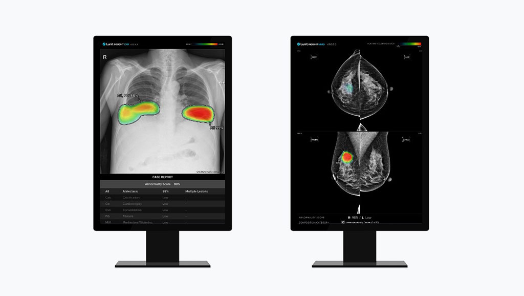 Image: Lunit INSIGHT CXR and Lunit INSIGHT MMG (Photo courtesy of Lunit)