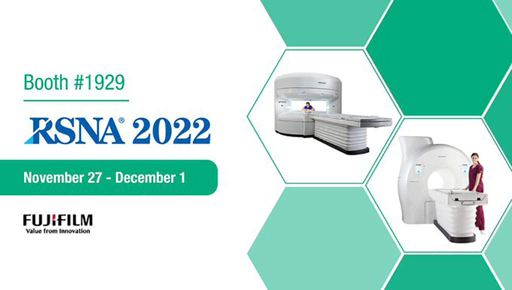 Image: The latest MRI innovations, including the OASIS Velocity and new Echelon Synergy, are on display at RSNA 2022 (Photo courtesy of FUJIFILM)