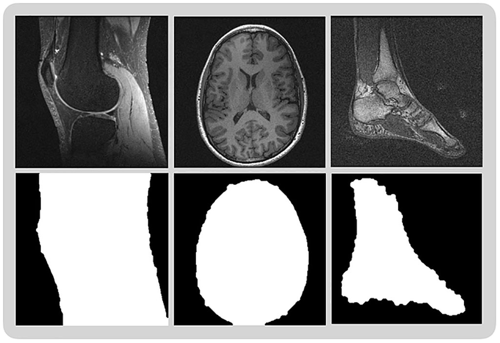 Image: Examples of MR images isolating field of view to focus on collecting data from body part being examined (Photo courtesy of University of Colorado School of Medicine)