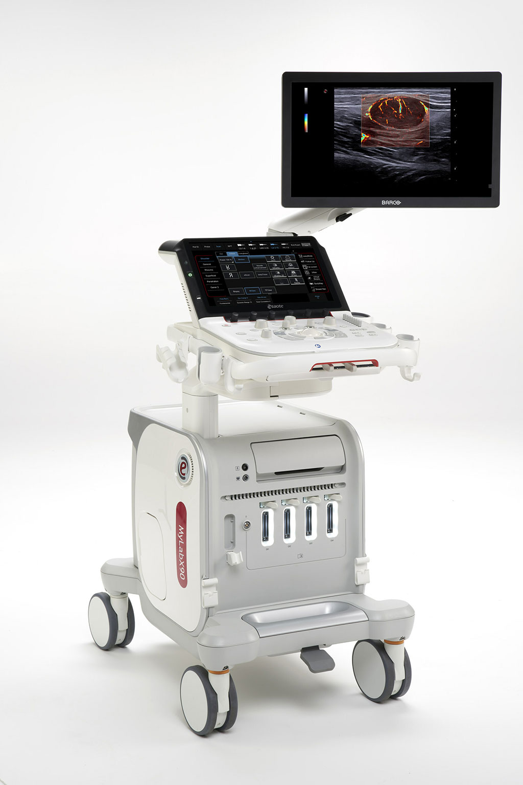 Image: The new MyLab X90 premium ultrasound system (Photo courtesy of Esaote)