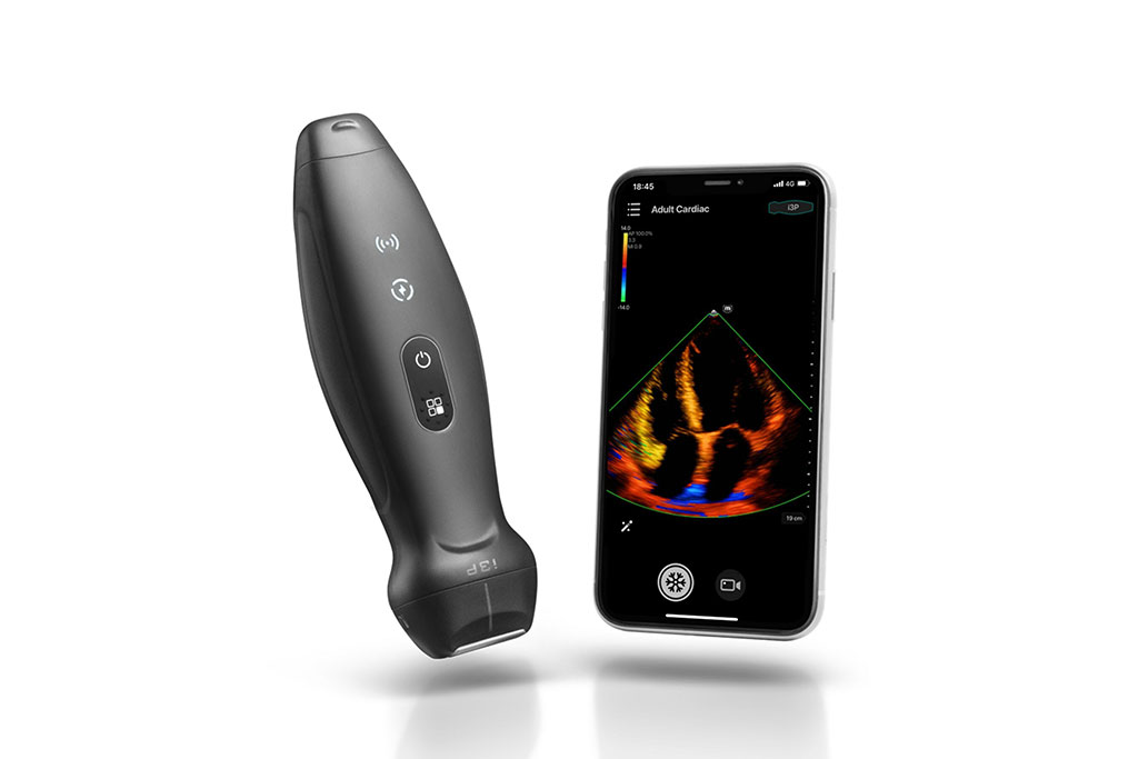 Image: The TE Air wireless handheld ultrasound system (Photo courtesy of Mindray)