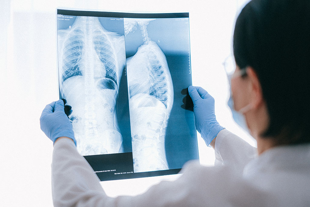 Image: Existing chest scans offer new opportunities for predicting surgical risks (Photo courtesy of Pexels)