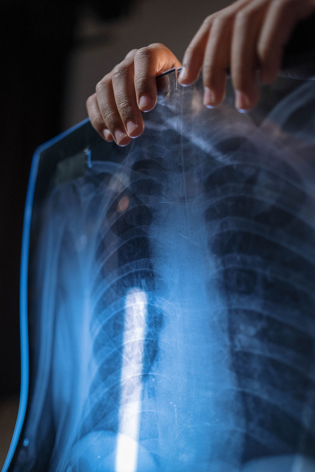 Image: An AI tool can accurately identify normal and abnormal chest X-rays in a clinical setting (Photo courtesy of Pexels)