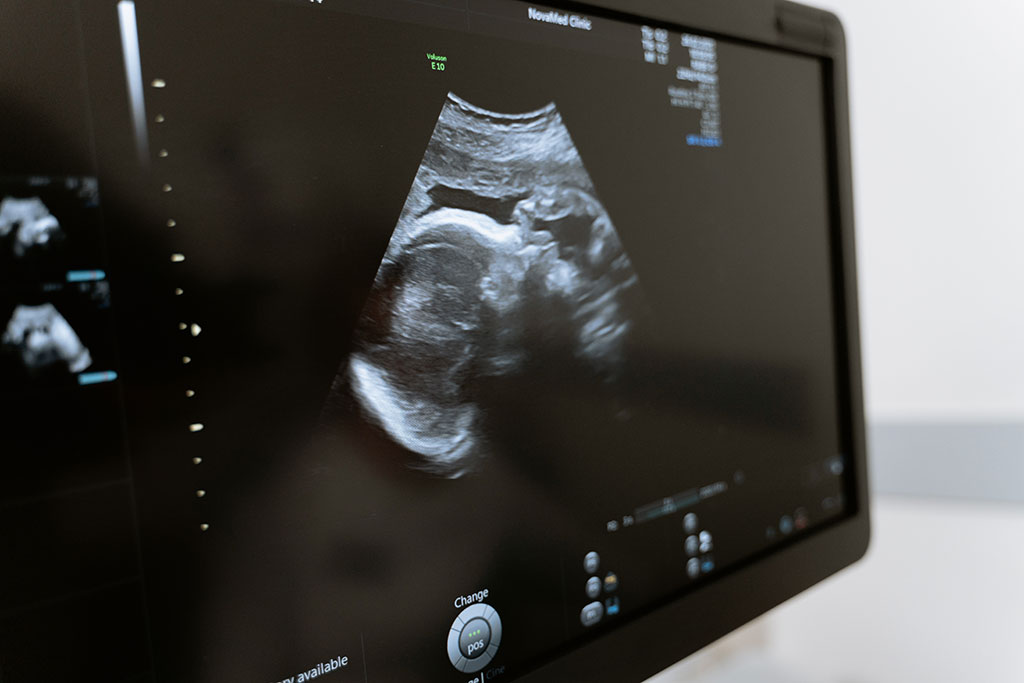 Image: New imaging tech produces real-time 3D maps of uterine contractions during labor (Photo courtesy of Pexels)