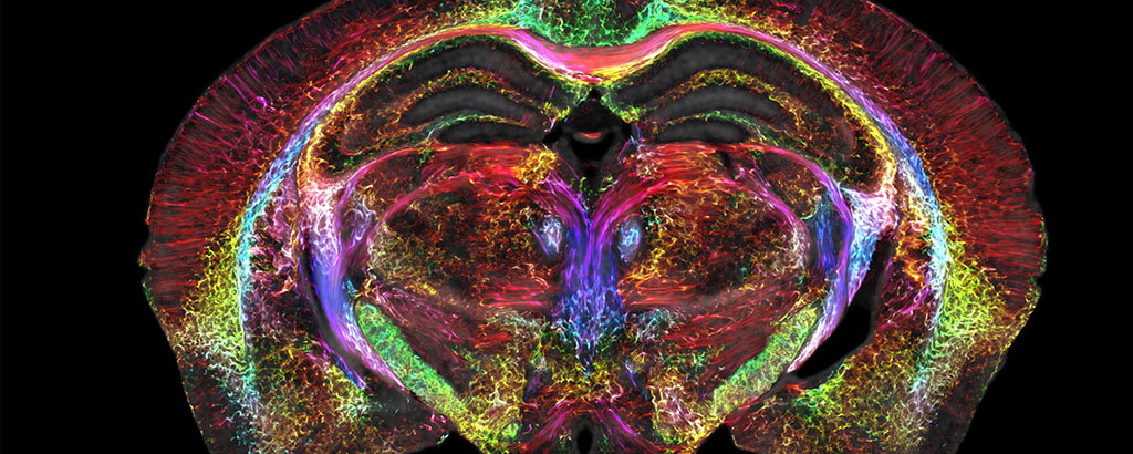 Image: MRI technology reveals the entire mouse brain in the highest resolution (Photo courtesy of Duke University)