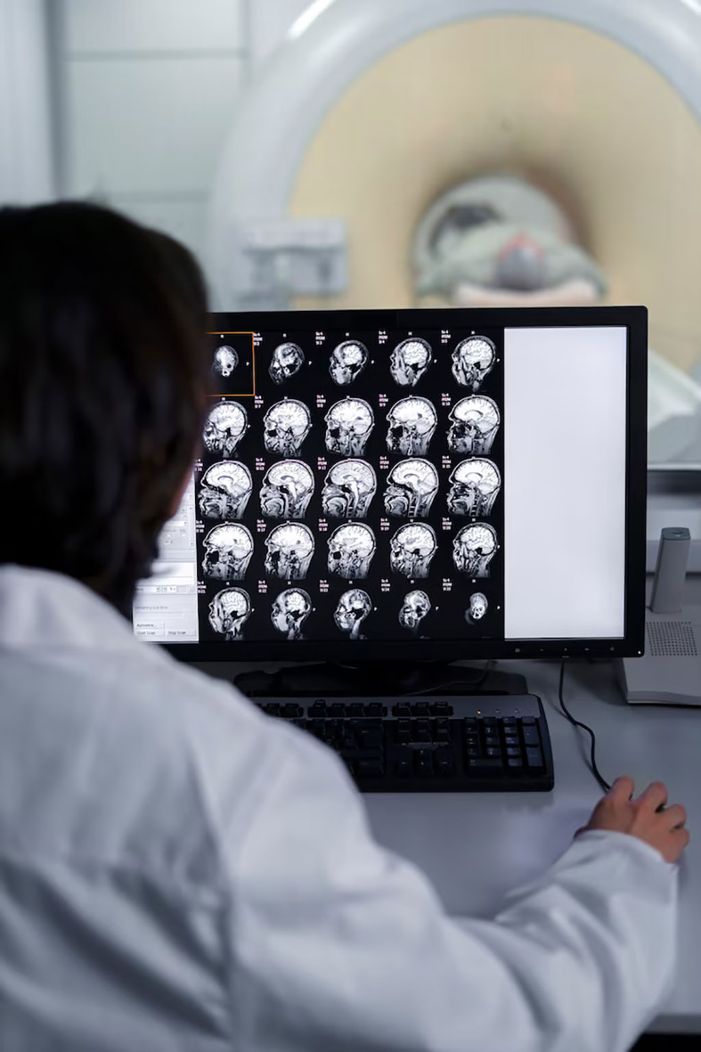 Image: FIRMM-pix is an innovative module for enhancing brain MRI acquisition efficiency and quality (Photo courtesy of Freepik)