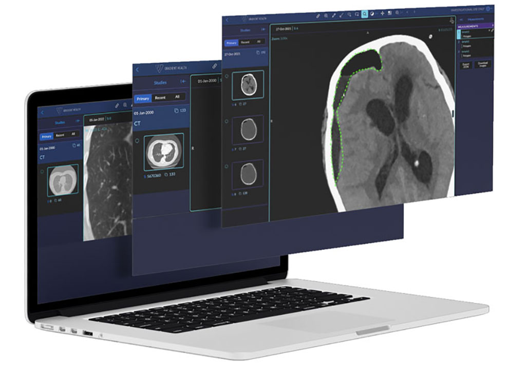 Image: A single, secure repository will provide access to a vast collection of annotated medical images (Photo courtesy of Gradient Health)