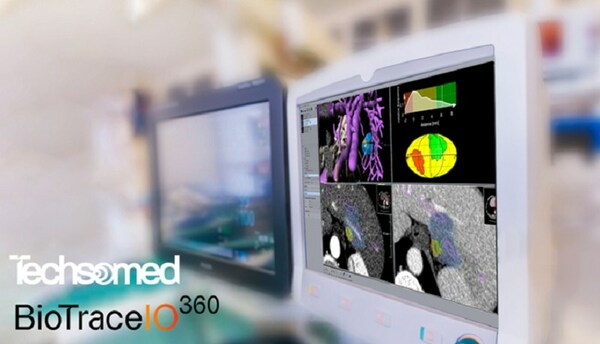 Image: The BioTrace.IO - AI-based image guided ablation therapy platform (Photo courtesy of Techsomed)