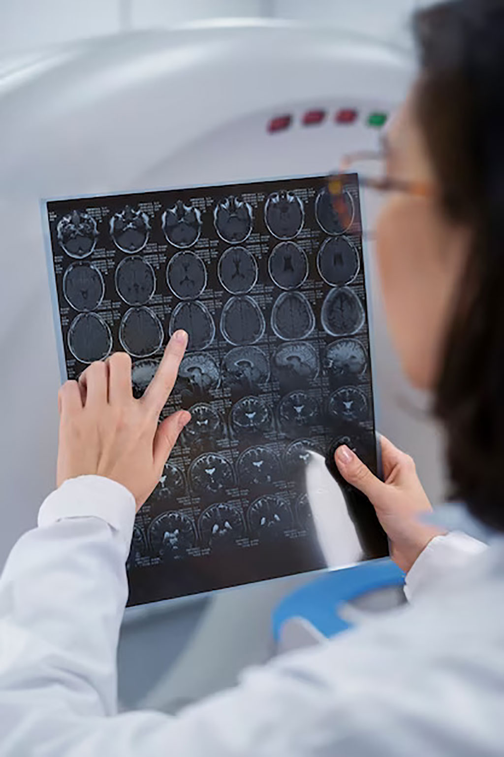 Image: PET imaging can help clinicians predict survival outcomes for patients with brain tumors (Photo courtesy of Freepik)
