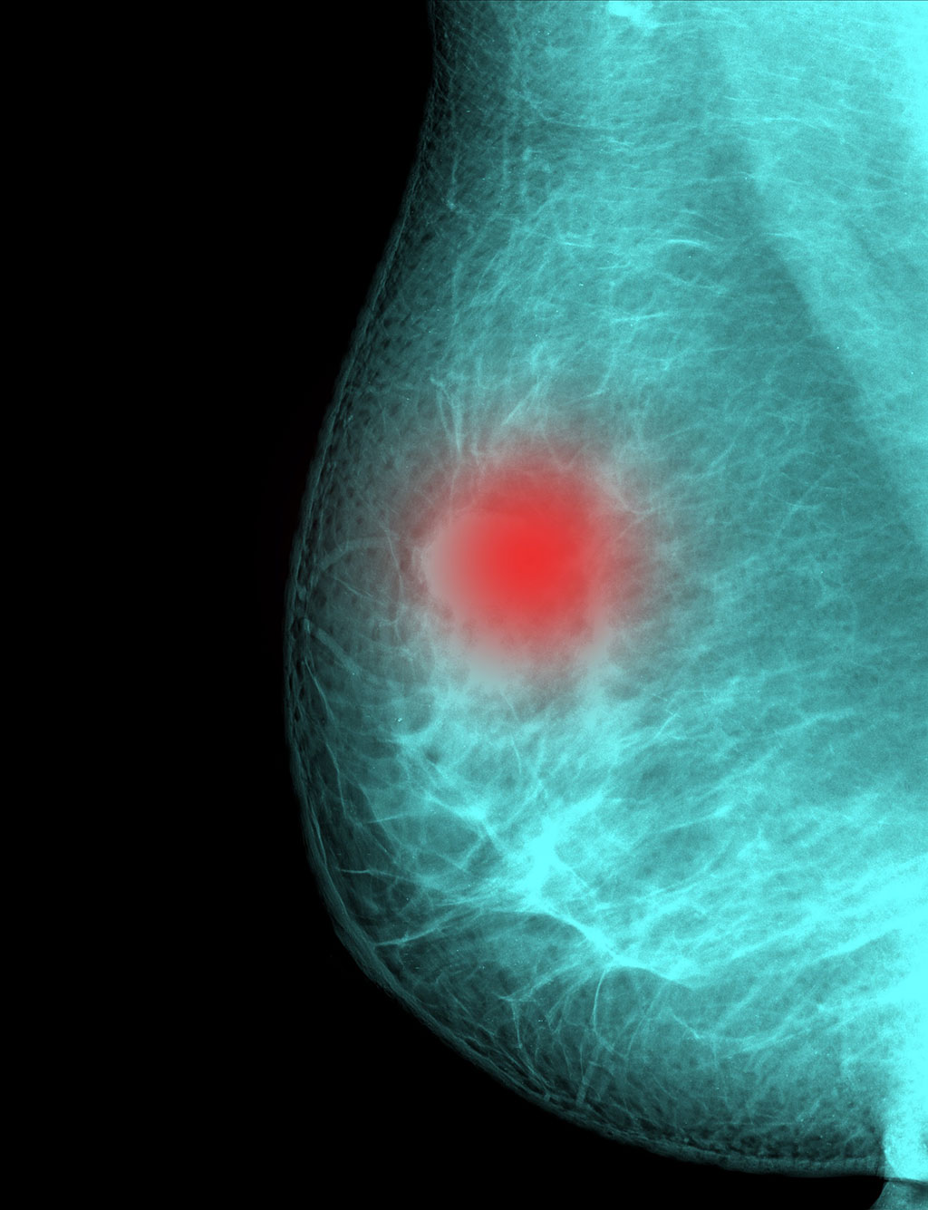 Image: AI performs comparably to human readers of mammograms (Photo courtesy of 123RF)