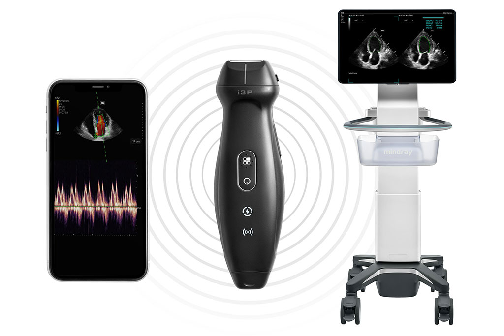 Image: The TE Air is the first handheld wireless ultrasound that can connect to a mobile device or ultrasound system (Photo courtesy of Mindray)