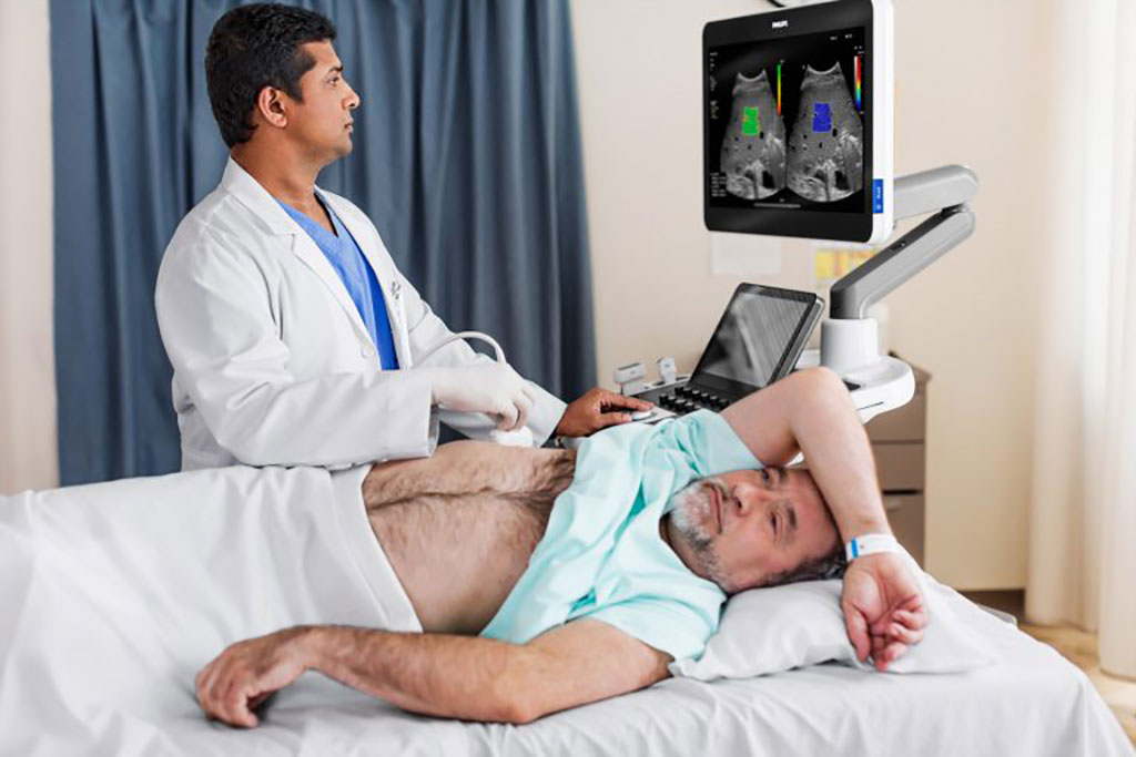 Image: The super resolution contrast-enhanced ultrasound application is available on the EPIQ Elite ultrasound system (Photo courtesy of Philips)