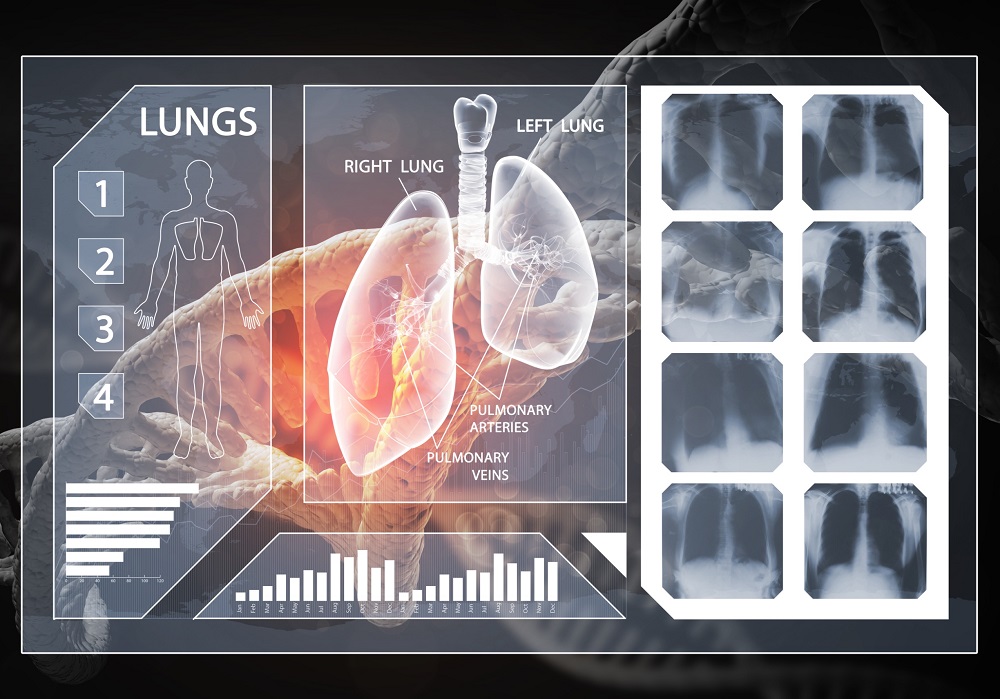 Image: The AI model has potential as an aid to radiologists in a time of growing workloads (Photo courtesy of 123RF)