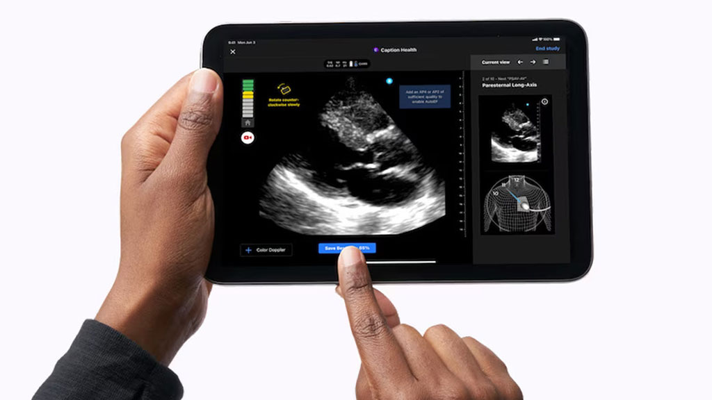Image: The new AI-augmented ultrasound technology aims to aid clinicians in diagnosing and treating traumatic injury (Photo courtesy of GE HealthCare)
