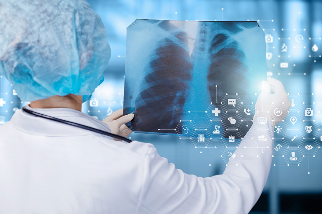 Image: DeepTek.ai has secured US FDA clearance for its CXR Analyzer chest X-ray AI solution (Photo courtesy of 123RF)