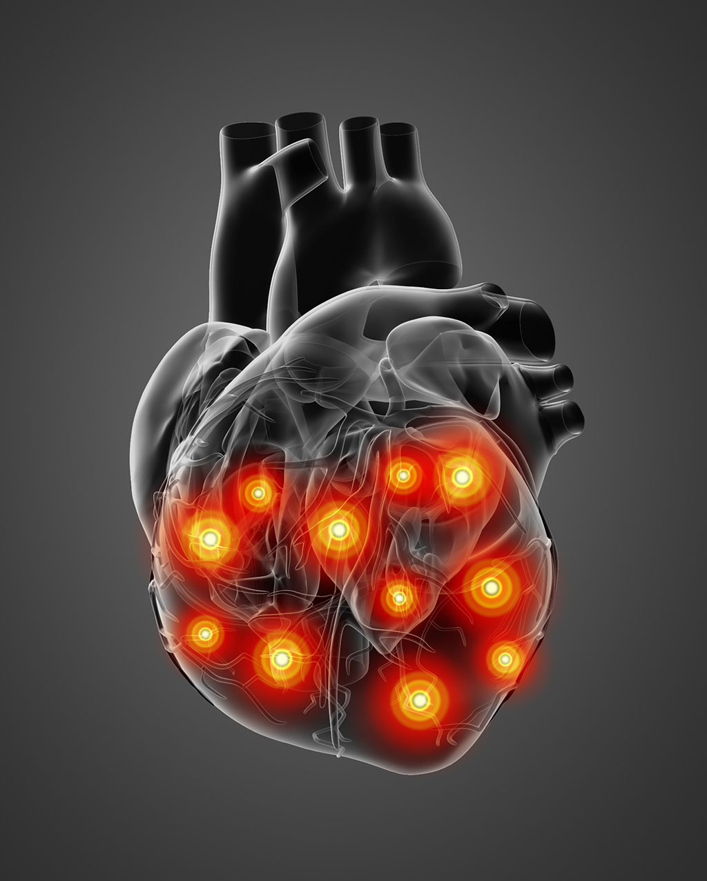 Image: A noninvasive technique helps scientists visualize immune cells in the human heart (Photo courtesy of 123RF)