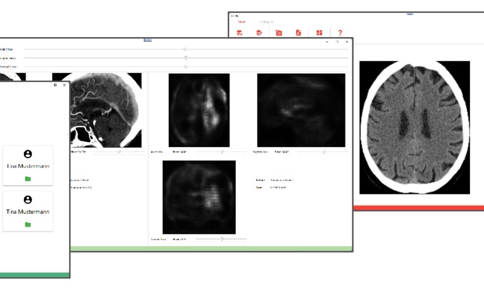 Image: Guardian should make it easy to analyze medical image data in future (Photo courtesy of RPTU/Maack, Gillmann)