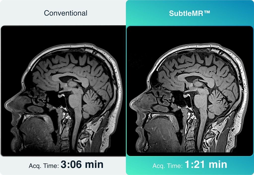 Image: SubtleMR enhances sharpness for head MRI (Photo courtesy of Subtle Medical)