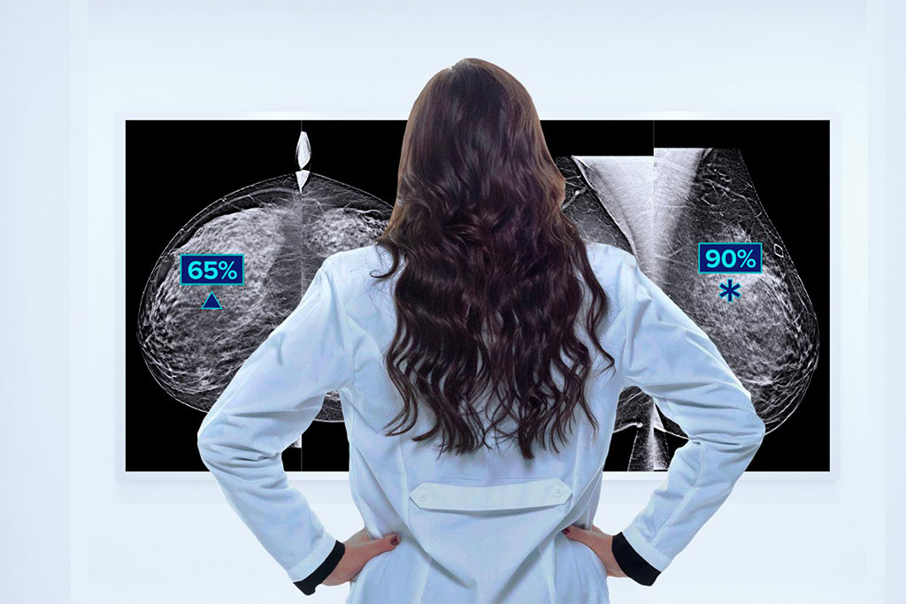 Image: Genius AI Detection uses deep learning technology to find cancers with improved accuracy (Photo courtesy of Hologic)