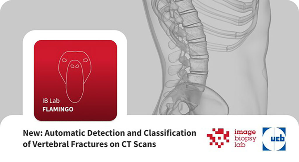 Image: IB Lab FLAMINGO is designed for the automatic detection and classification of vertebral fractures on CT scans (Photo courtesy of ImageBiopsy Lab)