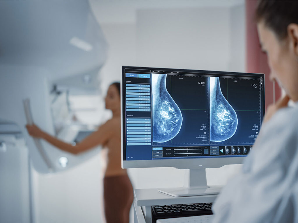 Image: ProFound AI predicts 1-2 year risk for breast cancer and reveals insights for heart disease (Photo courtesy of iCAD)