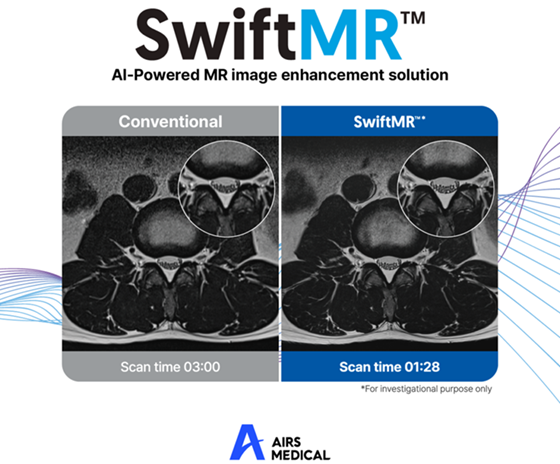 Image: SwiftMR has received EU Medical Device Regulation CE Certification (Photo courtesy of AIRS Medical)