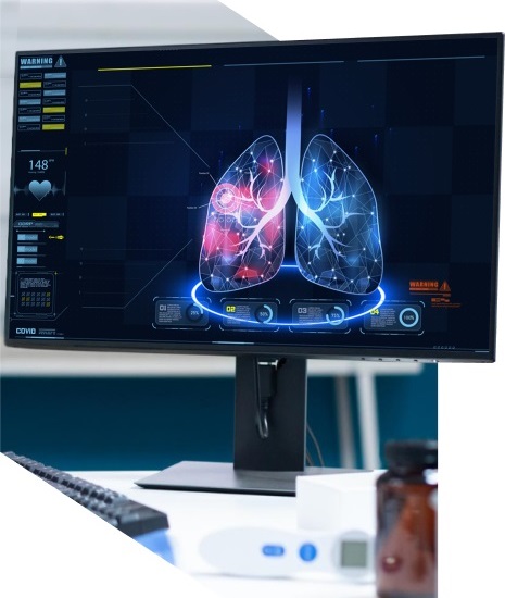 Image: The Fibresolve digital biomarker solution uses AI to guide safe, non-invasive diagnosis of lung fibrosis (Photo courtesy of IMVARIA)