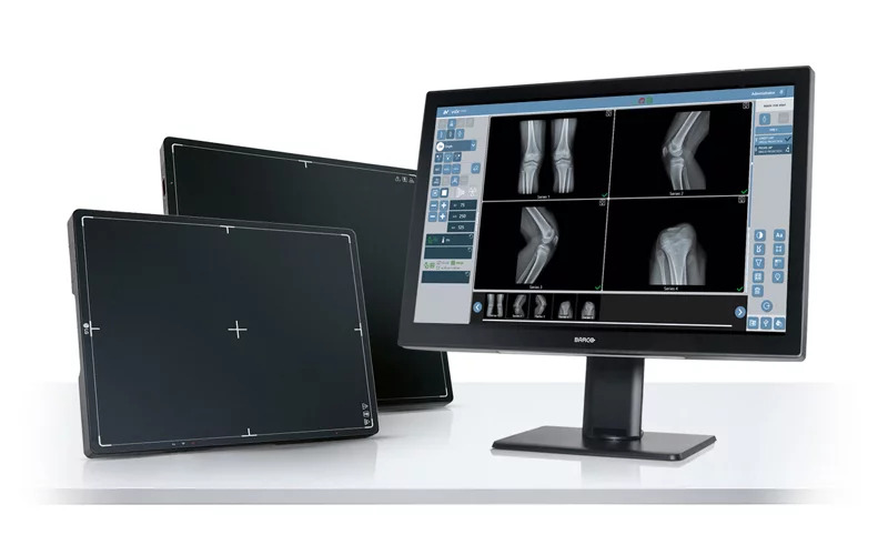 Image: The new VDX Next system is capable of digitizing any X-ray equipment (Photo courtesy of Villa Sistemi)