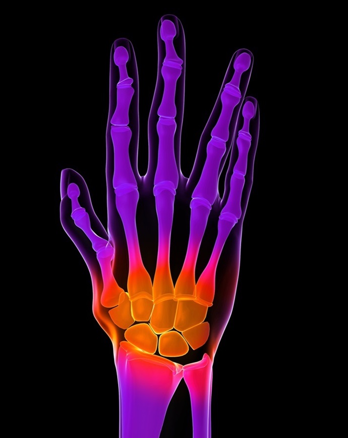 Image: The PET imaging technique can noninvasively detect active inflammation before clinical symptoms arise (Photo courtesy of 123RF)