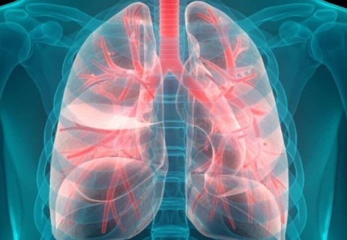 Image: AI extracts information about the chemical makeup of lung tumors from medical scans (Photo courtesy of Imperial College London)