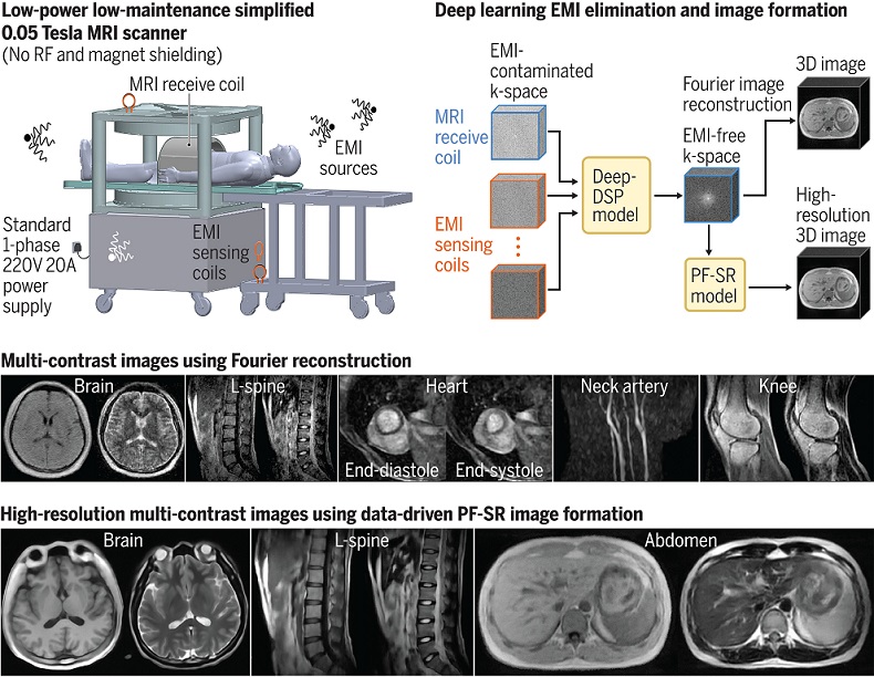 Image: Computing-powered whole-body MRI at 0.05 Tesla (Photo courtesy of Zhao, et al., doi: 10.1126/science.adm7168)