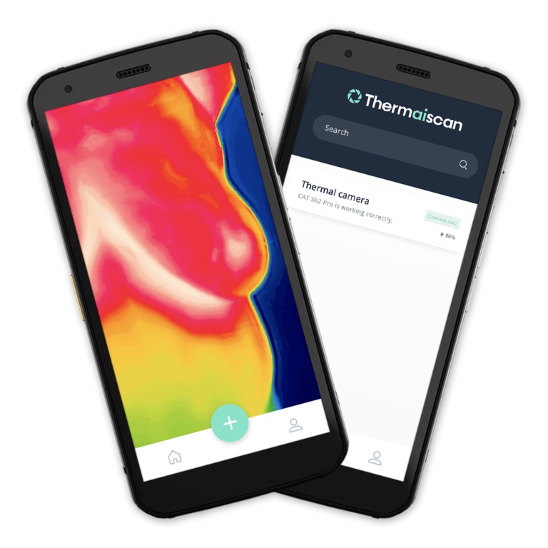 Image: AI analyzes smartphone-based thermal images of chest for breast cancer risk-predictions (Photo courtesy of Thermaiscan Technology)
