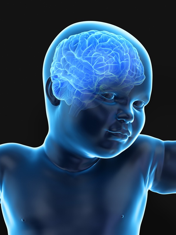 Image: Brain scans for babies could reduce risk of stroke later in life (Photo courtesy of 123RF)