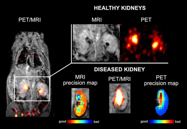 Image: Current PET/MRI imaging of healthy and damaged mouse kidneys using the dual contrast agent [18F][Gd(FL1)] (Photo courtesy of IOCB Prague)