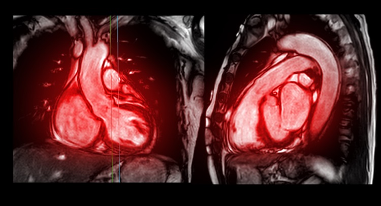 Image: New research suggests that MRI scans could replace invasive heart tests (Photo courtesy of 123RF)