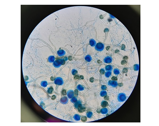 Image: Researchers have developed and tested a new imaging method that will allow specific detection of Aspergillus fumigatus fungal infections (Photo courtesy of Shutterstock)