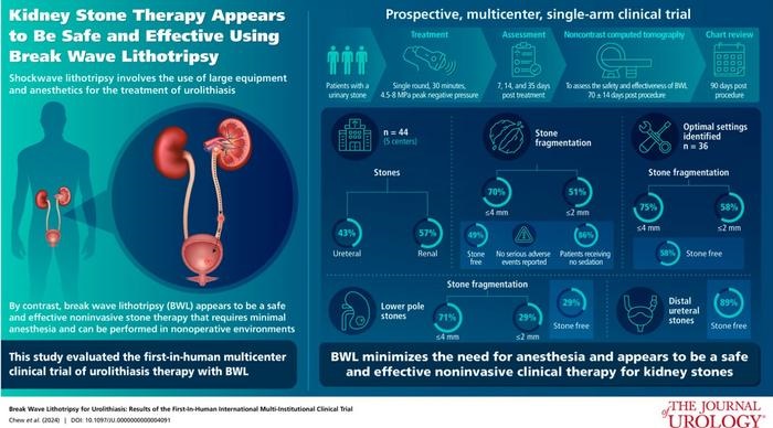 Image: Visual abstract of article “Break Wave Lithotripsy for Urolithiasis: Results of the First-in-Human International Multi-Institutional Clinical Trial” (Photo courtesy of Journal of Urology)