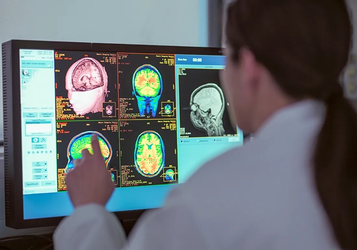 Image: MRI-linac allows clinicians to see what’s going on in the brain for the first time (Photo courtesy of Sylvester Comprehensive Cancer Center)