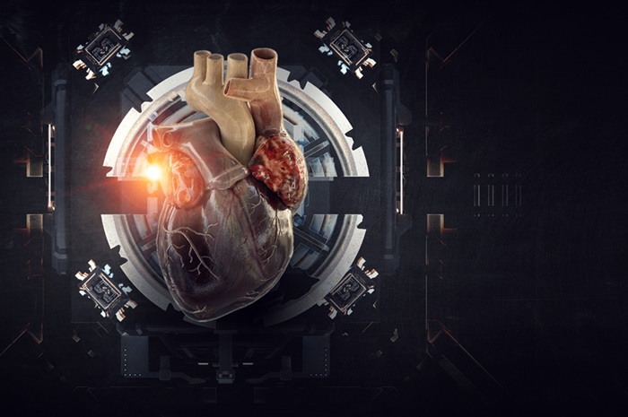 Image: The new image processing strategy for cardiac MRI identifies culprit areas underlying complex tachycardias (Photo courtesy of 123RF)